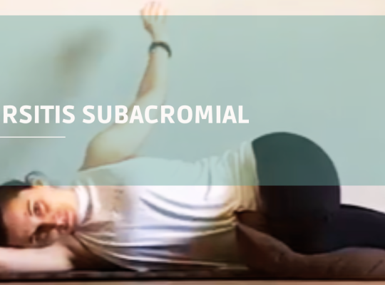 bursitis deltoidea