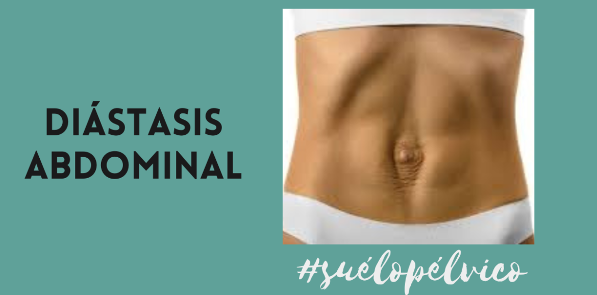 diástasis abdominal